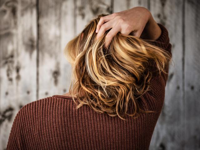 Pengertian Dan 3 Cara Mudah Mengatasi Permasalahan Ketombe Basah Beauty Fimela Com