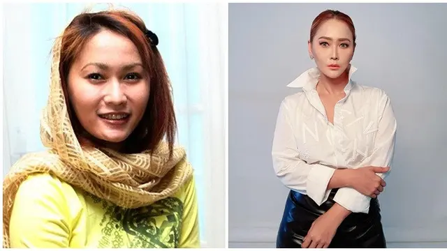 Beda Penampilan 10 Pedangdut Wanita di Awal Karier dan Kini, Jadi Sorotan
