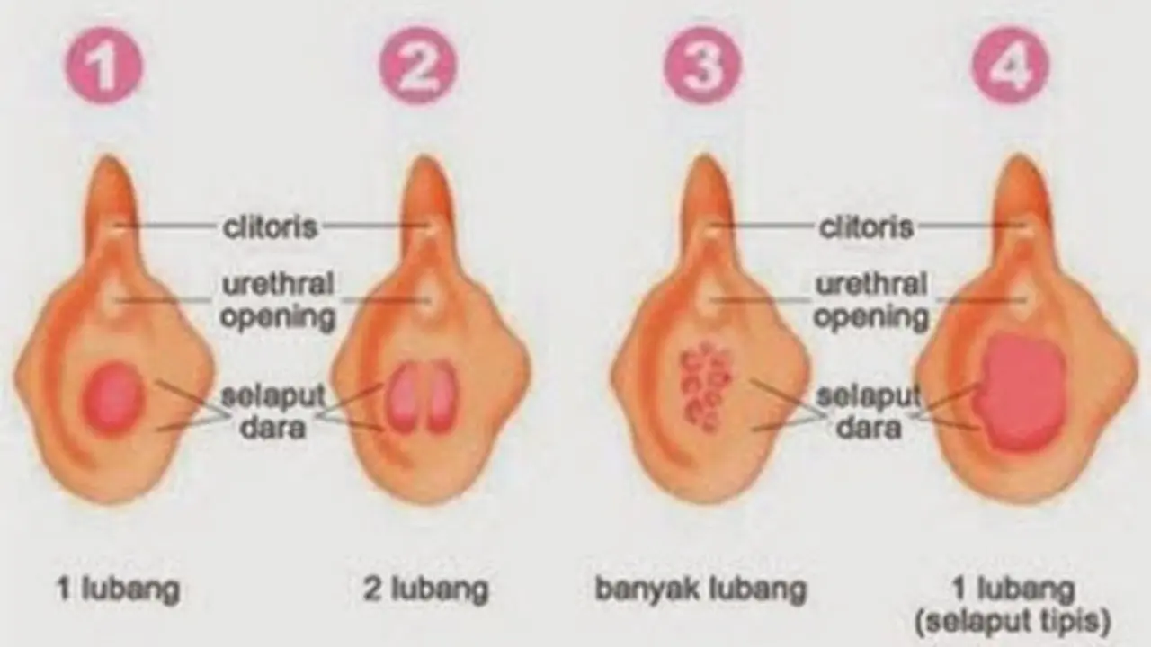 5 Hal Tentang Selaput Dara yang Perlu Diketahui Wanita