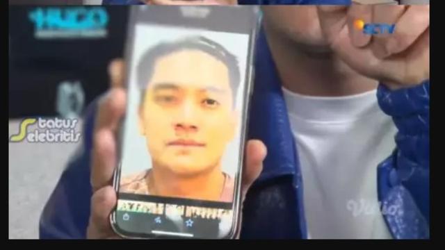 Boy William Ungkap Alasan Jalani Operasi Plastik untuk Ubah Bentuk Hidung