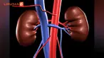 Walau tanpa organ ini, anda harus tetap didukung terapan ilmu kesehatan untuk bertahan hidup.
