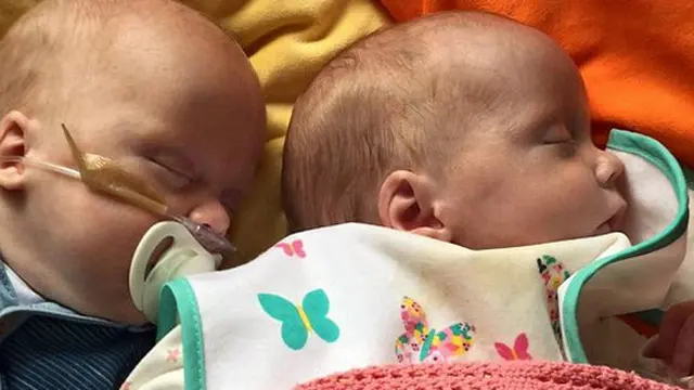 Foto: copyright Dailymail.co.uk/Caters News Agency