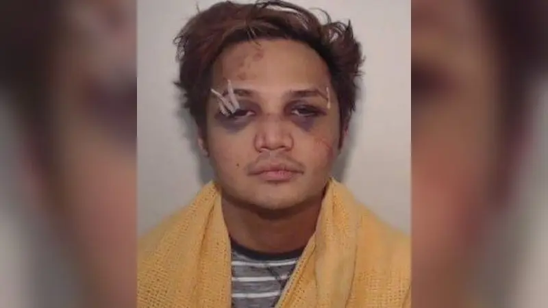 Dalam foto terbaru, predator seksual Reynhard Sinaga yang tinggal di Manchester, Inggris itu tampak babak belur pada bagian wajah (Greater Manchester Police)