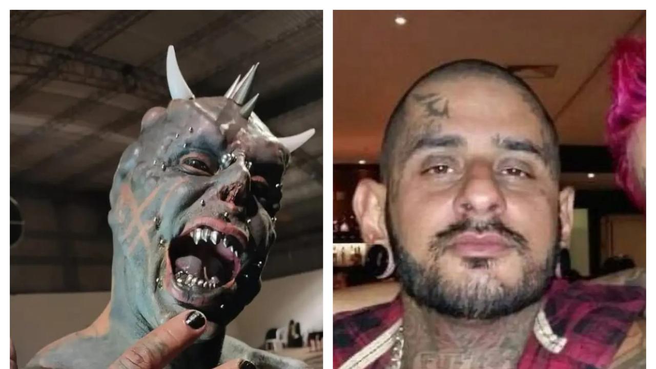 Pria Ini Jalani Operasi untuk Mengubah Tangan Jadi Cakar