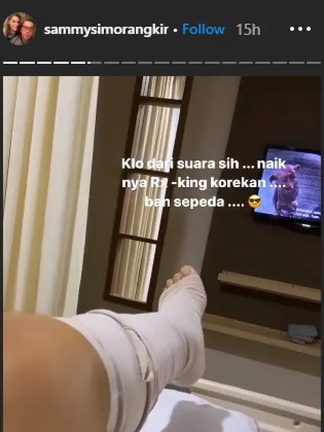 Sammy Simorangkir Patah Tulang Usai Kecelakaan, Ini 6 Potret Terbarunya