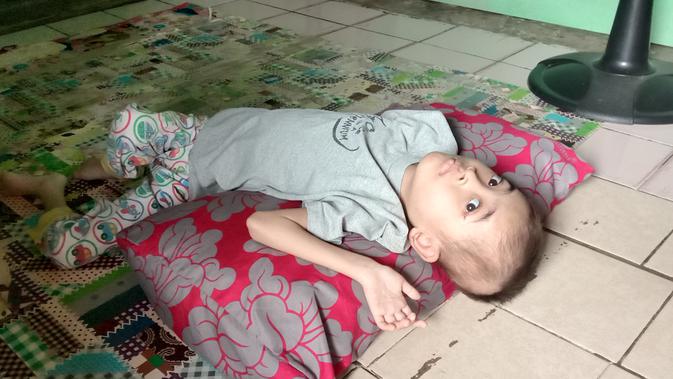 Anak sulung Herman dan Maiyah yang lumpuh sejak berusia 4 bulan. (Liputan6.com/Yandhi Deslatama)