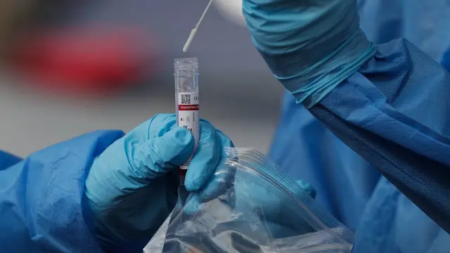 Beberapa lembaga kesehatan, termasuk CDC dan WHO, telah memantau gelombang baru Virus Corona COVID-19 Varian BA.2.86. (Arnulfo Franco/AP)