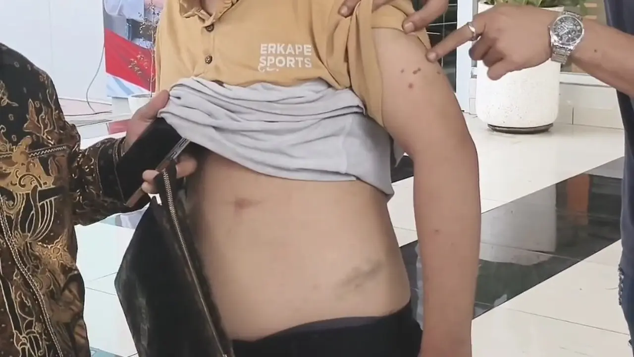 Korban penyiksaan bos koperasi di Tangerang