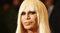 6 Seleb Hollywood dengan Operasi Plastik yang Gagal