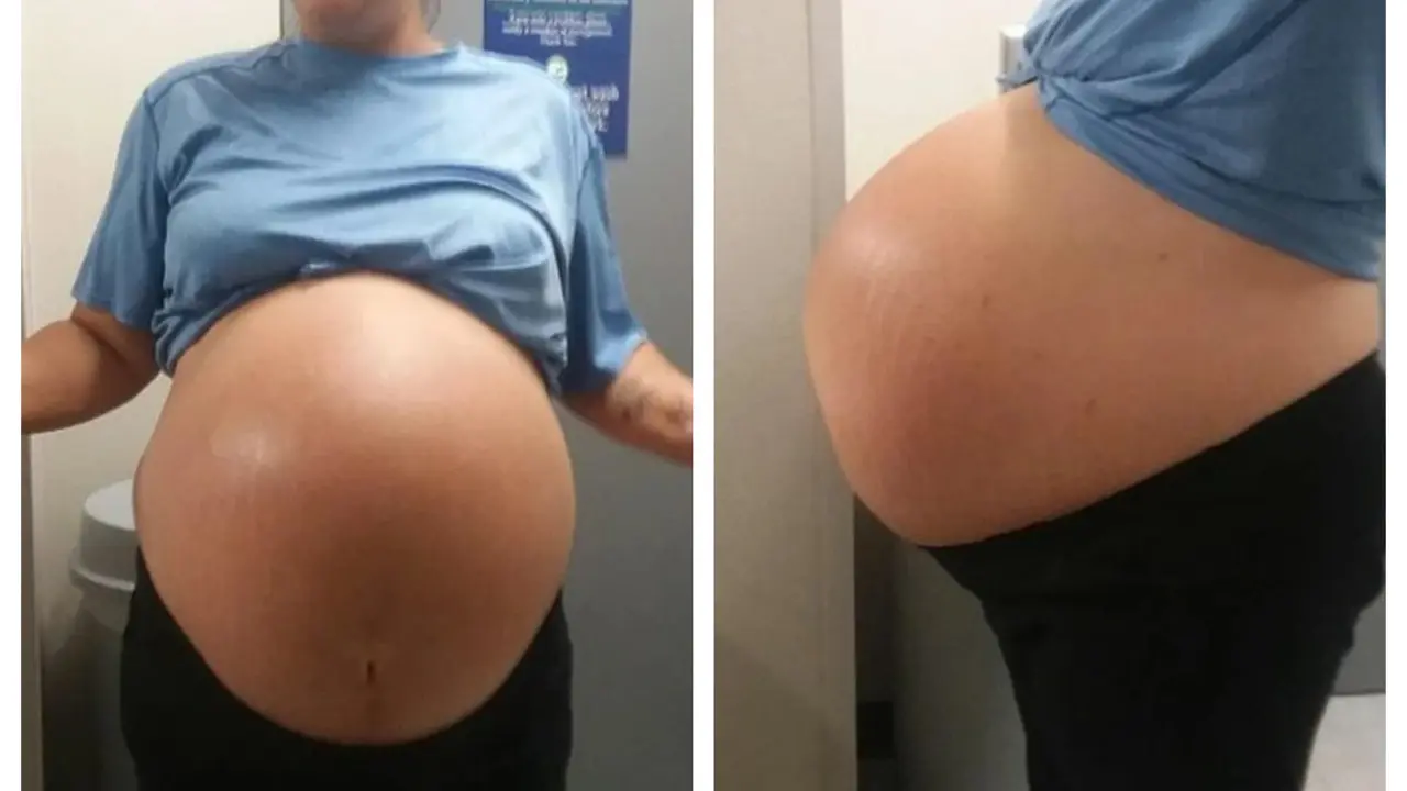 Melahirkan Bayi Seberat 13 Kg, Potret Wanita Saat Mengandung Ini Curi Perhatian