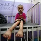 Dia mengatakan bahwa 1 dari 6 anak di bawah usia dua tahun mengalami malnutrisi akut di Gaza utara. (Bashar TALEB / AFP)