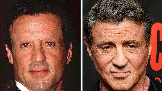 6 Artis yang Pernah Transplantasi Rambut, Terbaru Atta Halilintar