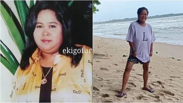6 Beda Penampilan Artis Sebelum dan Sesudah Sakit Diabetes, Jadi Lebih Kurus
