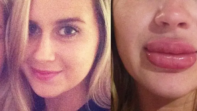 Photo: Copyright opposingviews.com