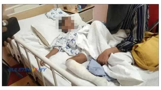 Main Sendiri di Luar Rumah, Bocah 5 Tahun Diserang Kawanan Monyet 30 Ekor Lebih