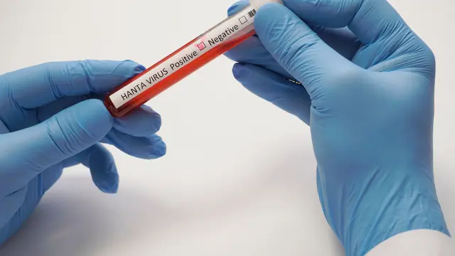 ilustrasi virus/shuttershock