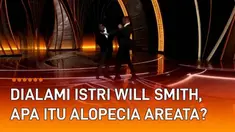 Insiden pemukulan aktor Will Smith pada Chris Rock di panggung Oscar 2022 membuat heboh dunia. Hal itu dipicu candaan Chris Rock soal gaya rambut botak istri Will Smith, Jada Pinkett Smith. Ternyata gaya rambut botak tersebut bukan semata-mata karena...