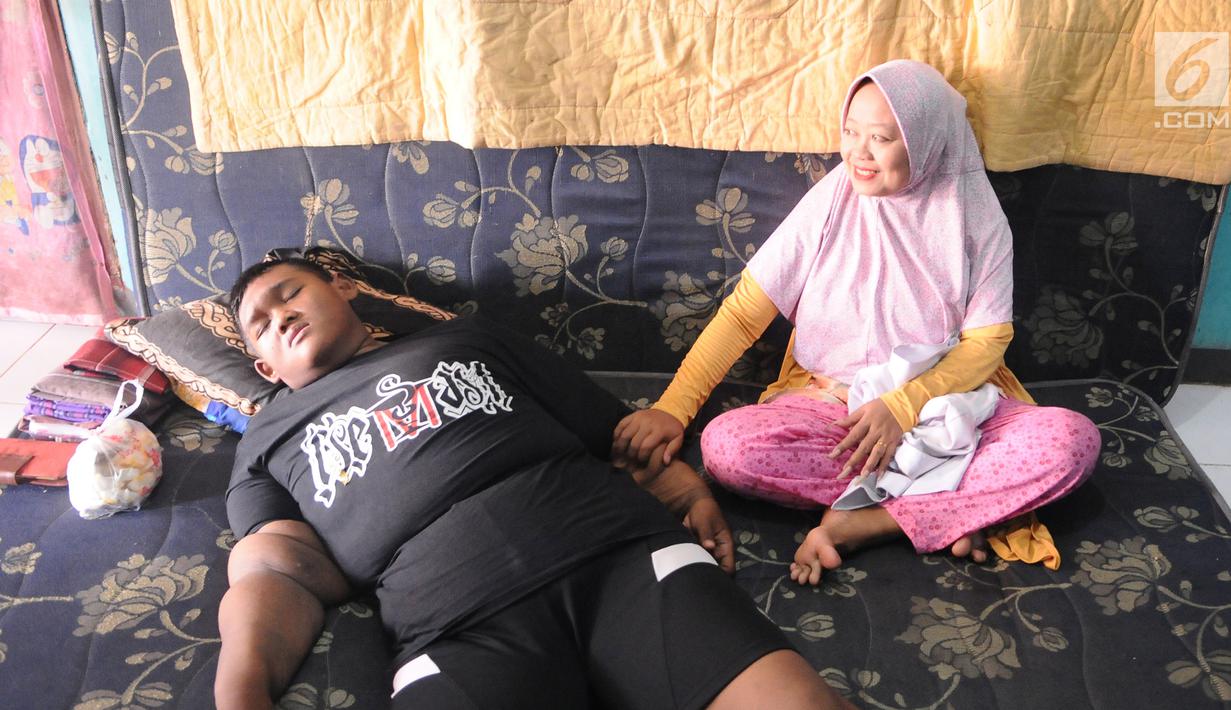 FOTO: Turun 105 Kilogram, Begini Penampakan Arya Permana ...