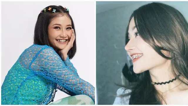 6 Potret Riyuka Bunga Sebelum dan Sesudah Oplas Hidung, Disebut