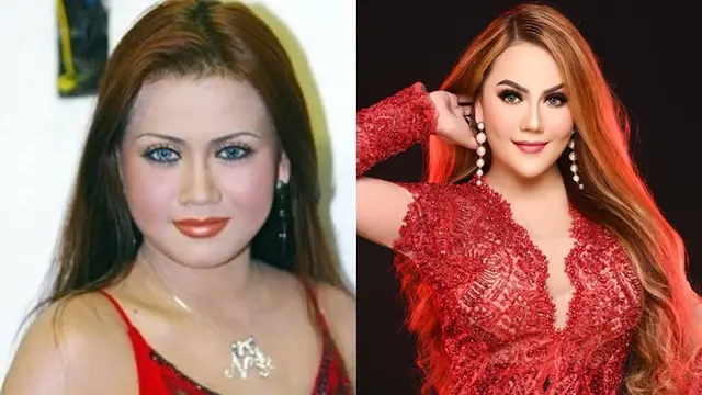 Beda Penampilan 9 Artis Sebelum vs Setelah Operasi Plastik, Bikin Pangling
