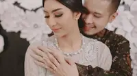 Mesranya Kekasih Peluk Tyas Mirasih Usai Lamaran