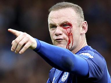 Striker Everton, Wayne Rooney, mengalami pendarahan di mata kirinya usai duel udara dengan bek Bournemouth, Simon Francis, pada Premier League, di Stadion Goodison Park, Sabtu (23/9/2017). Everton menang 2-1 atas Bournemouth. (AP/Barrington Coombs)