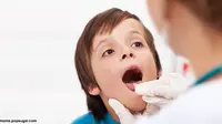Buang Amandel Perbaiki Perilaku Anak