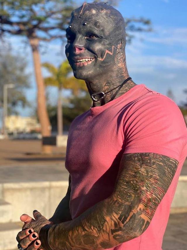 Terobsesi Menjadi Alien, Pria Ini Lakukan Modifikasi Ekstrem pada Tubuhnya