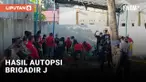 AUTOPSI