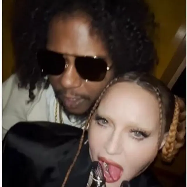 Reaksi Keras Madonna Usai Wajahnya Disebut Aneh dan Kebanyakan Oplas