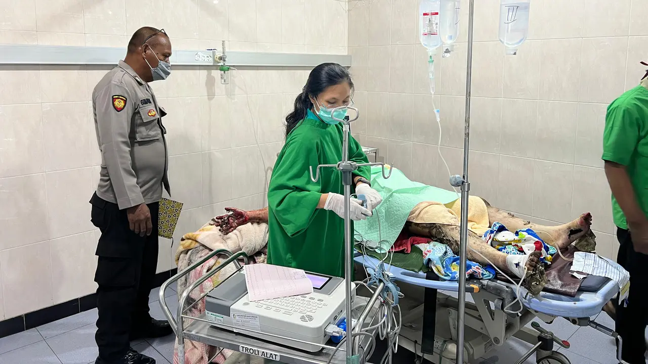 Istri di Banyuwangi sempat dirawat di rumah sakit usai dibakar suami. (Liputan6.com/ Hermawan Arifianto)