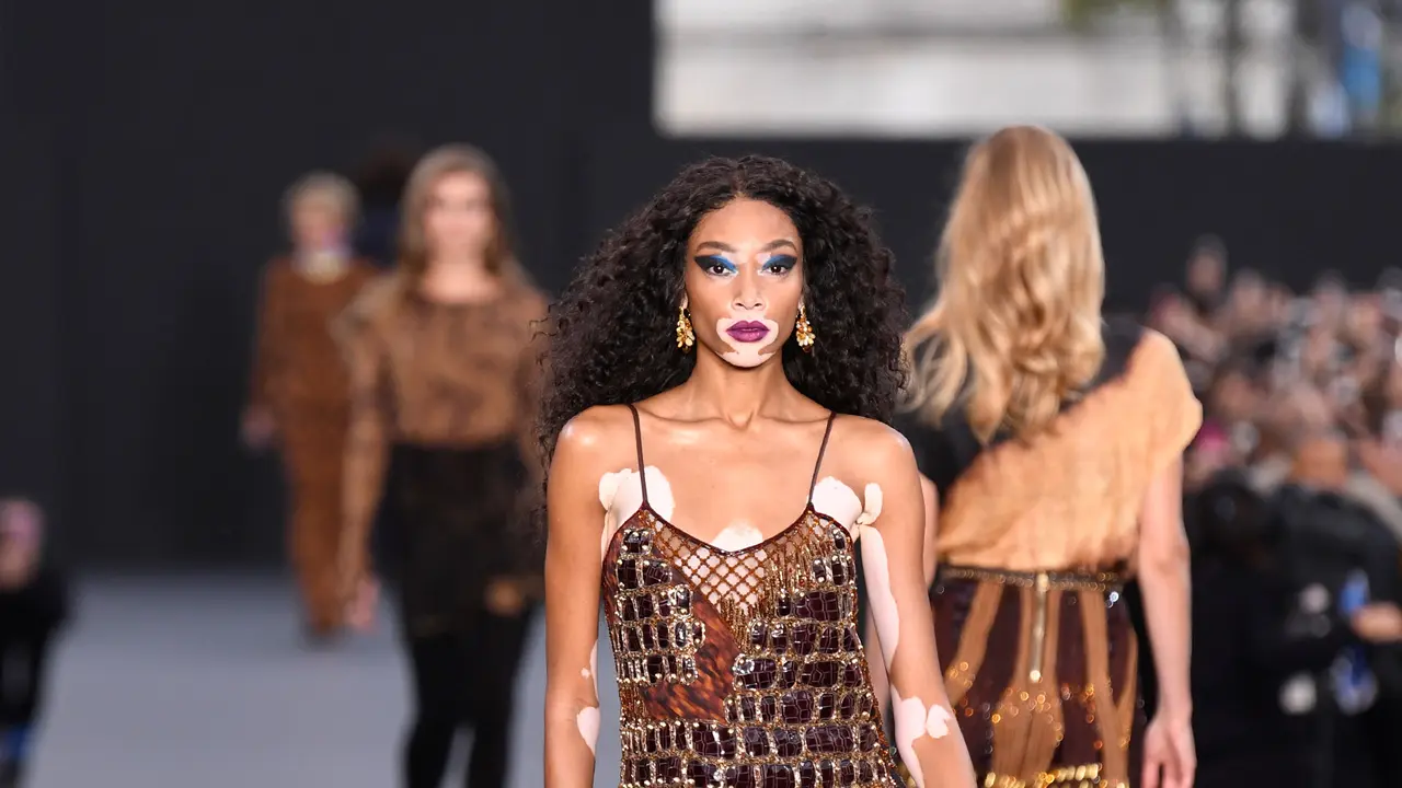 Winnie Harlow di Panggung Paris Fashion Week