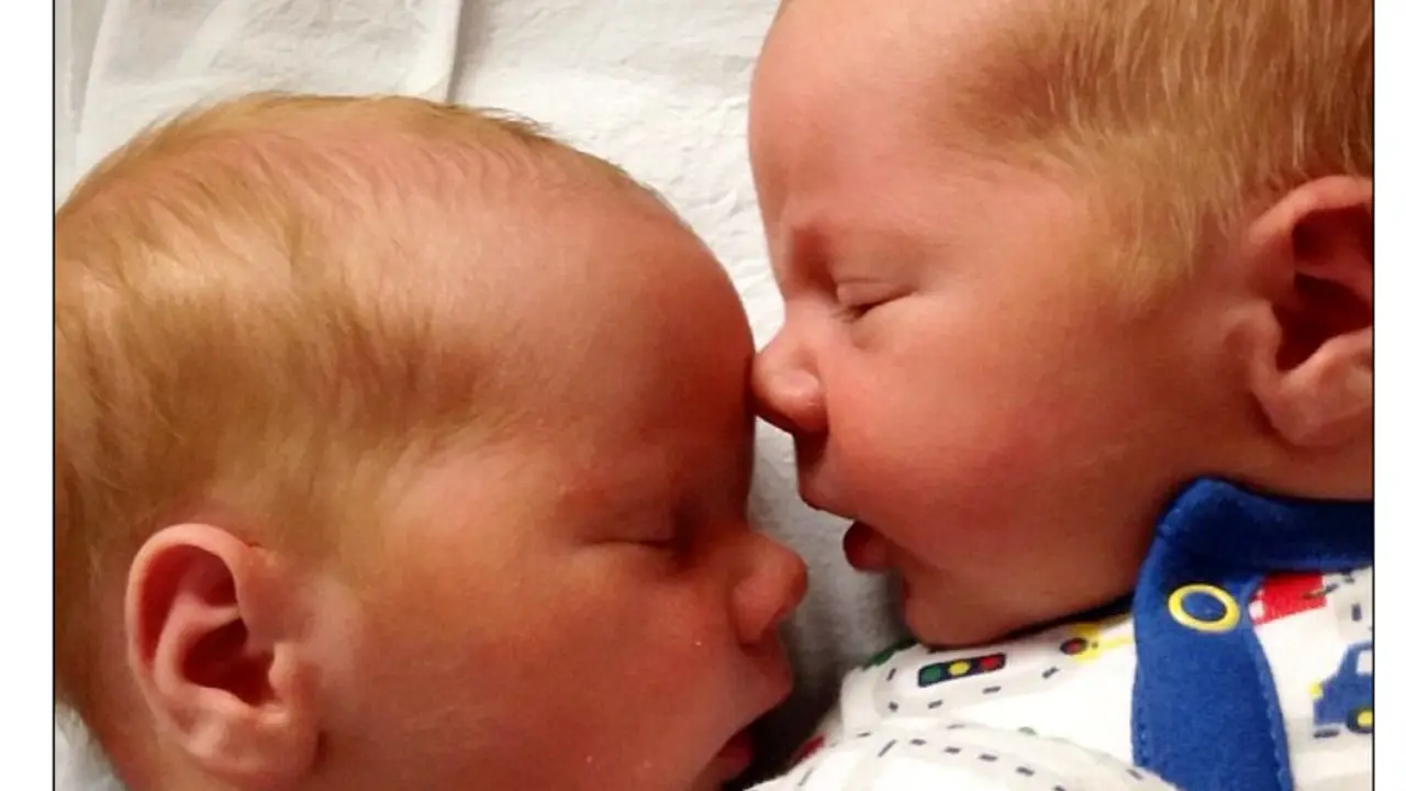 Bayi kembar di Skotlandia 