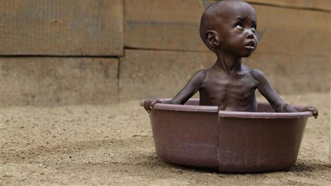 Ilustrasi anak Zimbabwe yang kelaparan. (niketalk.com)