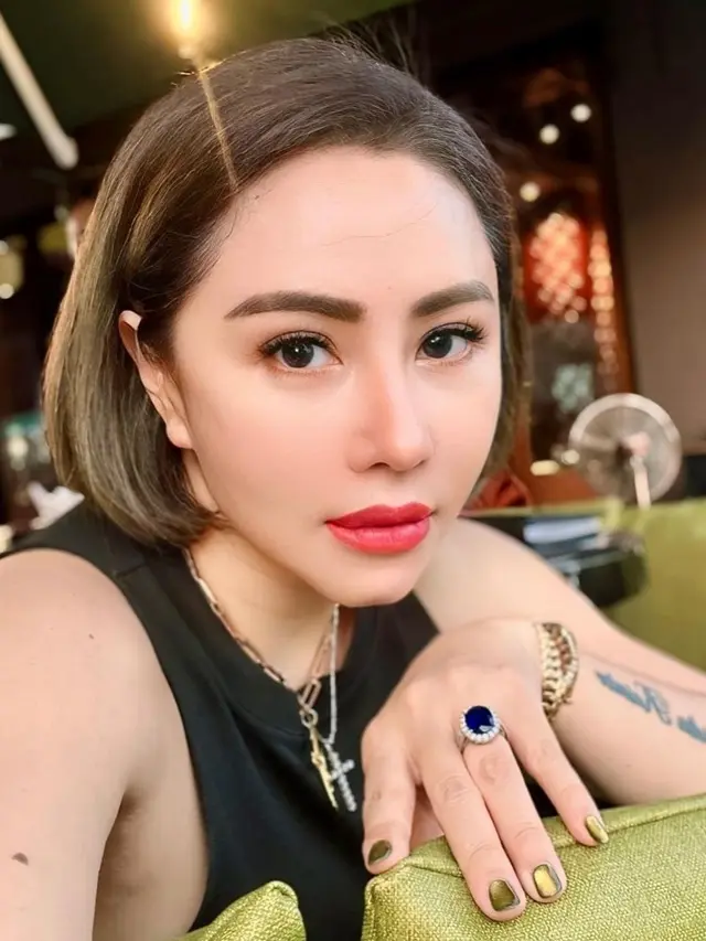 Pernah Koma Hingga Amnesia dan Tak Kenali Orang