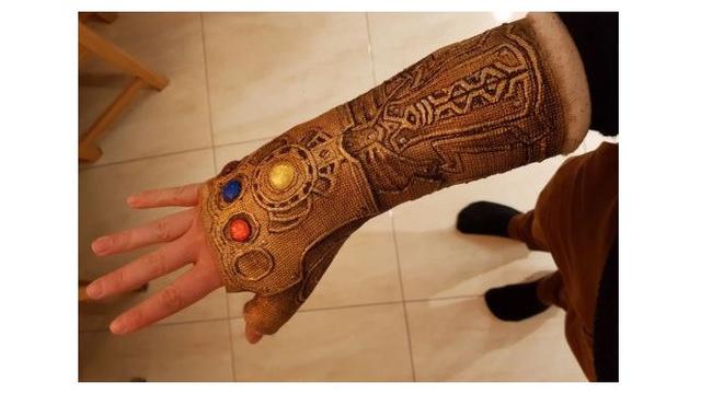 Pergelangan Tangannya Cedera, Pria Ini Gunakan Hiasan Gips yang Unik