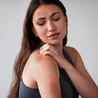 Penyebab dan cara mengatasi chicken skin alias keratosis pilaris. (foto/dok: freepik)