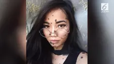 Meski sejak kecil sering dicemooh karena tanda lahir di tubuhnya, gadis berusia 20 tahun ini tersebut tetap percaya diri.
 