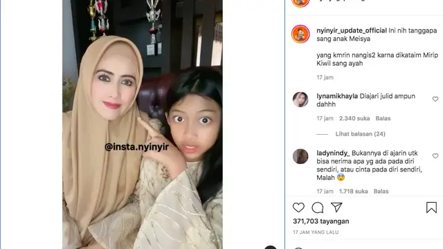Kerap Dibully dan Dibilang Mirip Kiwil, Putri Meggy Wulandari Sentil Warganet