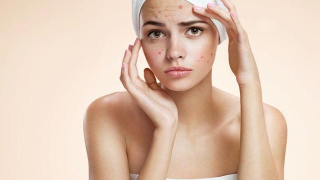 Tips Merawat Wajah untuk Kulit Sensitif