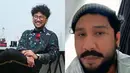 Penyanyi Kunto Aji memiliki identitas penampilan rambut kribo dan berkacamata. Lalu apa jadinya jika Kunto Aji melepas kacamatanya? Tentu akan membuat para penggemarnya merasa pangling dengan paras Kunto Aji. (Liputan6.com/IG/kuntoajiw)