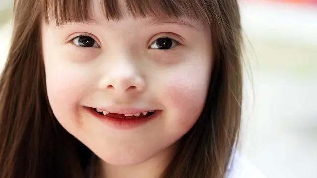 Down Syndrome