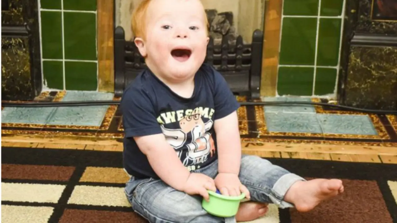 Jack Clayton, Bocah Down Syndrome yang Jadi Bintang di Sosmed