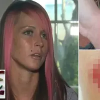 Hati-hati! Ini alasannya kamu tidak boleh membiarkan ikat rambut ber-glitter melingkar di pergelangan tanganmu. 