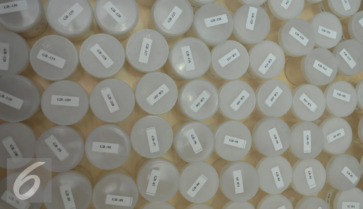 Botol untuk test urine siswa calon anggota Paskibraka tingkat nasional 2016 di siapkan di Rumah Sakit Olah Raga Nasional Menpora Cibubur, Jakarta Timur, untuk jalani Seleksi Kamis (21/7). (Liputan6.com/Johan Tallo)