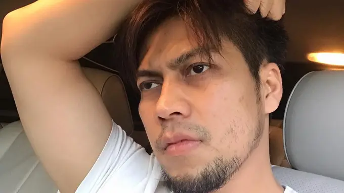 [Bintang] Sunu eks Matta Band