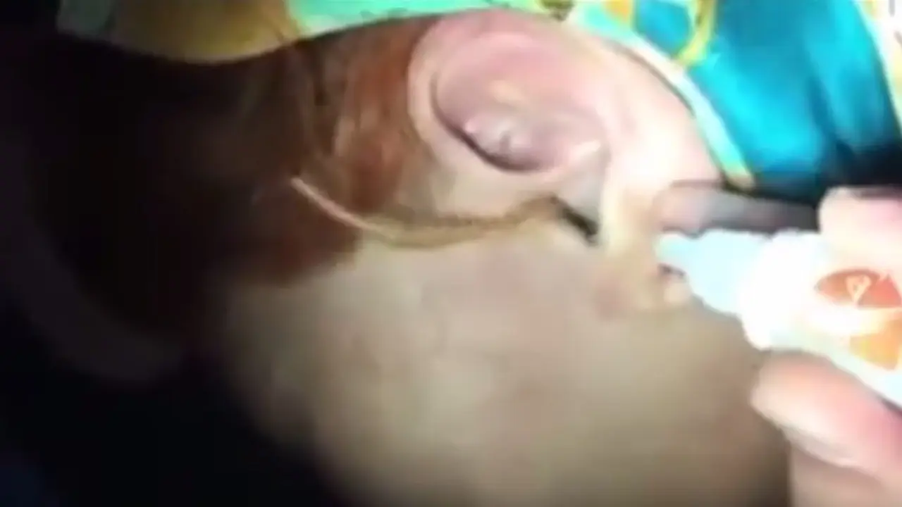 lipan, hewan masuk ke telinga