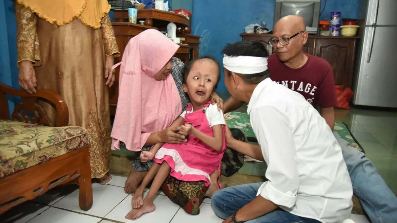 Suci Galih Andayani (9) tiba-tiba menebar tawa saat calon Wakil Gubernur Jawa Barat Dedi Mulyadi menjenguknya. (Liputan6.com/Abramena)