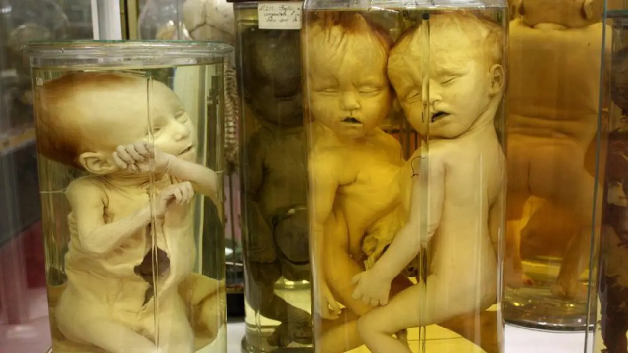4 Koleksi Museum Ini Membuat Kamu Tak Bisa Tidur Nyenyak