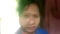 Kisah Pilu Wanita Disabilitas 15 Tahun Menderita Benjolan Aneh di Pipi